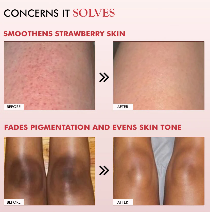 11% AHA BHA Strawberry Body Lotion for Skin Smoothening - Image 6