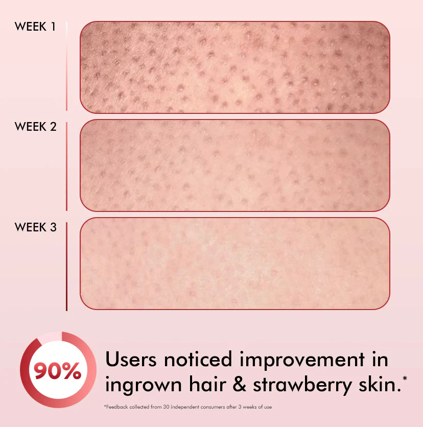 11% AHA BHA Strawberry Body Lotion for Skin Smoothening - Image 7