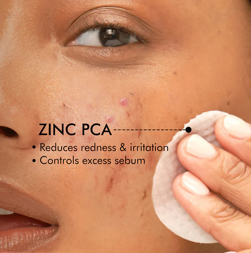 2% Salicylic Acid Serum-Acne Pads with Matcha Tea - 40 N - Image 4