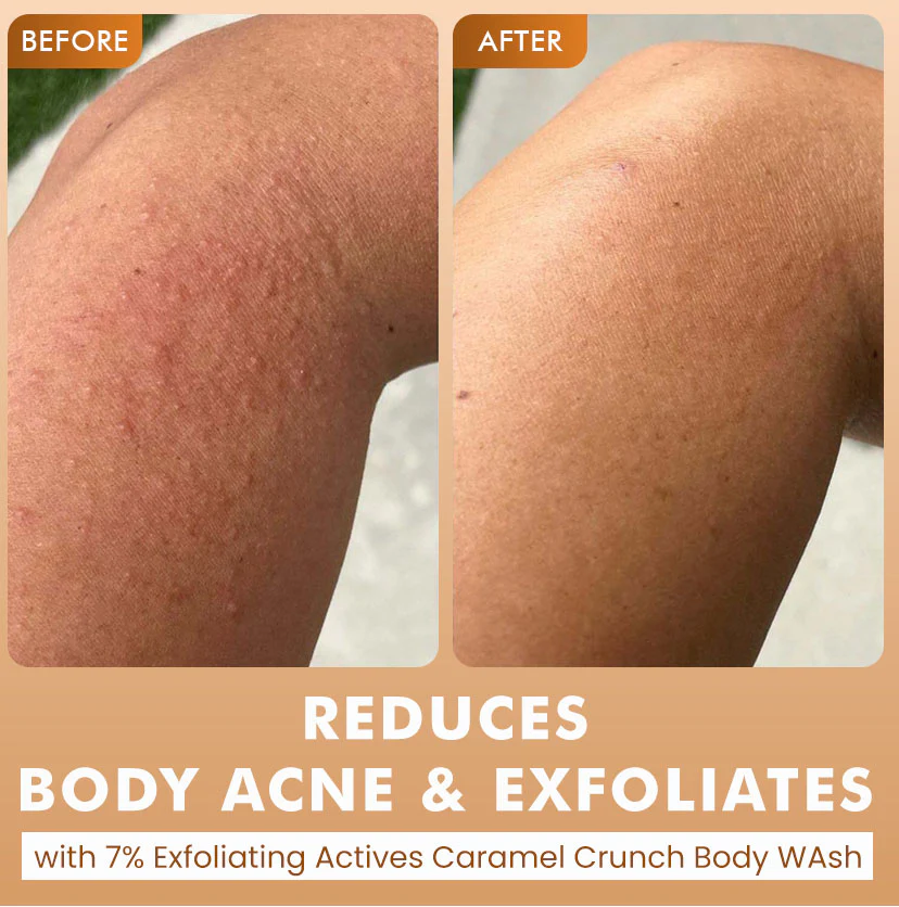 De-Tan & Exfoliating Body Washes (Set of 2) - Image 4